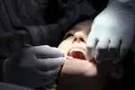 Zahnversicherung